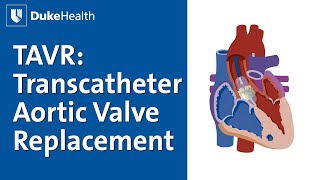 TAVR Transcatheter Aortic Valve Replacement Explained  Duke Health [upl. by Jacobba]