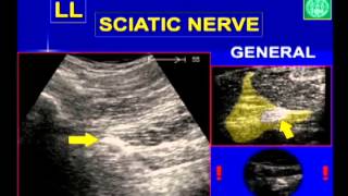 Regional Anesthesia  Sonoanatomy I Upper and Lower Extremities [upl. by Eibbob544]