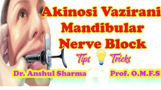 AKINOSI VAZIRANITECHNIQUELANDMARKSCLOSED MOUTHMANDIBULAR NERVE BLOCKCOMPLICATIONSMALAMED [upl. by Carena110]