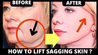 🛑 CHISELED JAWLINE EXERCISE  LIFT SAGGING SKIN SAGGY CHEEKS JOWLS LAUGH LINES FOREHEAD [upl. by Hillier770]