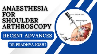 Recent Advances in Anaesthesia for Shoulder Surgery I Dr Pradnya Joshi [upl. by Isadora]