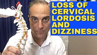 Ep24 Does Loss Of Lordosis Cause Dizziness And Vertigo Dr Walter Salubro Chiropractor in Vaughan [upl. by Mellitz]