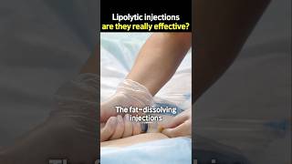 Lipolytic injections are they really effective [upl. by Aivilo]