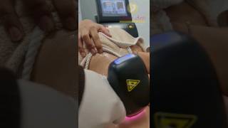 Underarms Laser Hair Removal at SkinArts HairFree CareFree PainFree LaserHairRemoval [upl. by Anihcak]