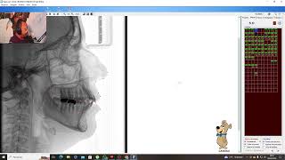 Apresentação Aula Cefalométria Odontológica Computadorizada [upl. by Imis]