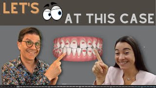 How to build an Invisalign ClinCheck treatment plan [upl. by Atikan800]