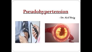 Pseudohypertension  Dr Akif Baig [upl. by Marilyn896]