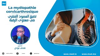 Dr Fethi Bayoudh  La myélopathie cervicarthrosique [upl. by Nerland]