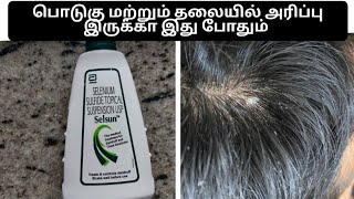 selsun shampoo for dandruff review in tamil  anti dandruff shampoo itchy scalp [upl. by Ahsad]