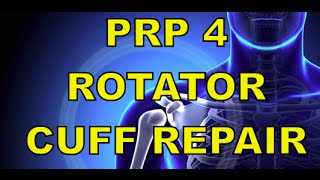 PRP for Shoulder Labrum and Rotator Cuff Why not steroids and YES to PRP [upl. by Ariajay618]