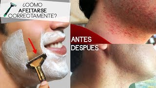 ¿CÓMO AFEITARSE HOMBRES  Consejos para evitar alergias después de rasurar [upl. by Ntisuj]