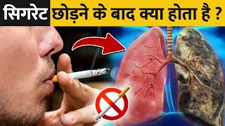 सिगरेट छोड़ने के 72 घंटे बाद क्या होता है   What Are The Withdrawal Symptoms of Quitting Smoke [upl. by Zigrang134]