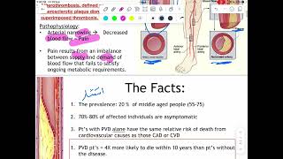 Peripheral vascular disease part 1 باطنية [upl. by Harbard172]