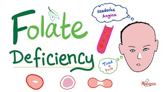 Folate deficiency  Megaloblastic Anemia  Macrocytic  Hematology Series [upl. by Alleram532]