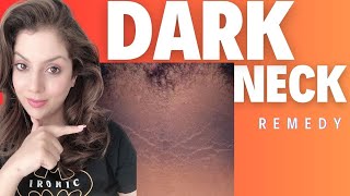 Dark Neck Treatment at Home I Dark Neck Remedy I Acanthosis Nigricans Treatment [upl. by Ahsykal]