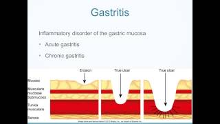 Alterations in Digestive Function [upl. by Garrek703]