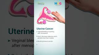 Gynecological Cancer Awareness Month  Dr Nikhil Mehta [upl. by Enelrak654]