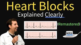 Heart Blocks Explained  First Second Third Degree and Bundle Branch on ECG [upl. by Irahc167]