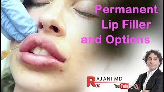 Permanent Lip Filler and OptionsDr Rajani [upl. by Arabel]