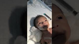 Chestryped for newborn baby😌 sumitnicunursingstm youtubeshorts nursing newbornbaby chestworkout [upl. by Butch]