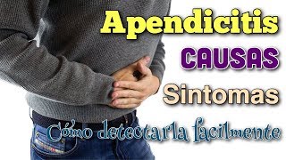 ▶︎ APENDICITIS 5 SINTOMAS 🔥 que NO FALLAN GARANTIZADO👨‍⚕️ [upl. by Rufford356]