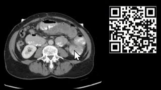 Mastering CT Abdomen and Pelvis Emergency Course [upl. by Eisle]