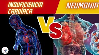 Cómo diferenciar neumonia de insuficiencia cardiaca para principiantes [upl. by Peterman542]