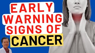 Early Warning Signs of Cancer  By Doctor Willie Ong Internist amp Cardiologist [upl. by Aliekahs]