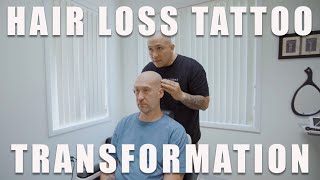 Hair Loss Tattoo Transformation Scalp Micropigmentation [upl. by Neal]