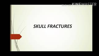 Skull fractures Forensic medicine [upl. by Sulokcin]