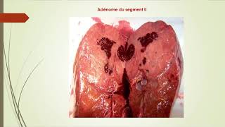 Module de Gastrologie [upl. by Nilyarg616]