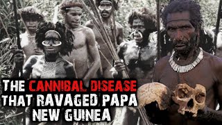 Kuru  The Cannibal Disease in Papua New Guinea [upl. by Wolfgram752]