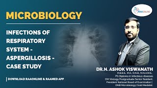 Microbiology  Aspergillosis  Case study  Raaonline [upl. by Egdirdle223]