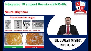 🕉Integrated 19 subject Revision INR48Neurolathyrism by Dr Devesh Mishra [upl. by Natal881]