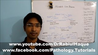 Alcoholic Liver Disease Part 1 HD [upl. by Noiztneb]