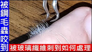 手被玻璃纖維刺到如何處理【What to do if your skin is punctured by fiberglass】被海水鋼毛蟲咬到處理方法 [upl. by Valenza]