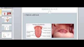 Thyroid Disorders  Hypo and Hyperthyroidism  Surgery Lecture [upl. by Ozkum991]