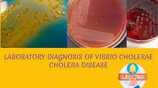 Laboratory diagnosis of Vibrio cholerae in hindi [upl. by Dnomaj]