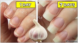 How to grow nails with garlic in just a week😻 [upl. by Palgrave]