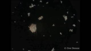 One Disease  Scabies mites [upl. by Snook]