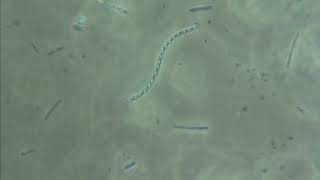 A LOOK AT SPORE FORMING BACTERIA [upl. by Antoinette]