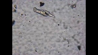 Rotifer Bdelloidea in movement [upl. by Anitsuga]