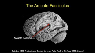 CARTA Comparative Anthropogeny Human Arcuate Fasciculus [upl. by Denna739]