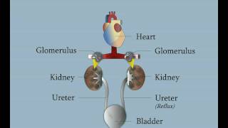 Vesicoureteral Reflux [upl. by Allin]