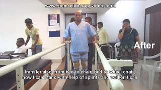 Treatment for Spinal Cord Injury [upl. by Irpac]