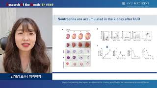 SNU MEDICINE 이달의 연구 2022년 7월 의학과 김혜영 교수님 [upl. by Macdermot]