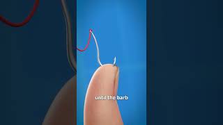 How To Remove A Fishhook 😱 [upl. by Kate]