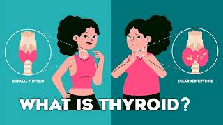 Thyroid Gland T3 T4 Thyroid Hormones and Thyroid Problems Animation thyroid [upl. by Dorion]