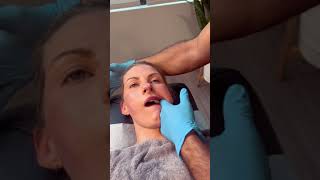 PAINFUL TMJ JAW TREATMENT 😥 [upl. by Tena697]