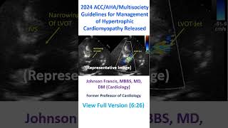 2024 ACCAHAMultisociety Guidelines for Management of Hypertrophic Cardiomyopathy Released [upl. by Arramahs]